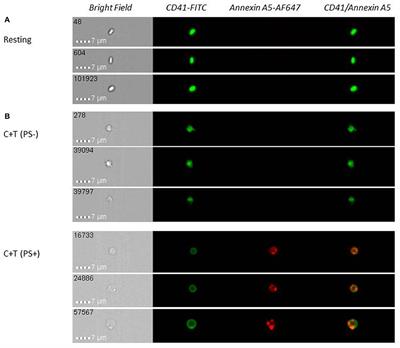 Procoagulant Phosphatidylserine-Exposing Platelets in vitro and in vivo